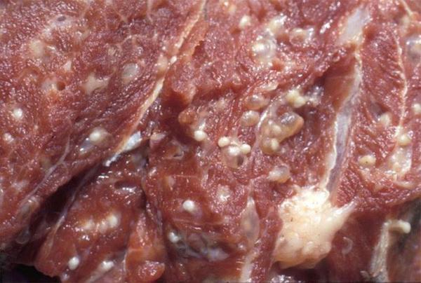 Hãi hùng hơn 100 người nhiễm sán dây lợn: Cảnh báo kiểu ăn uống khiến cả búi sán làm tổ - Ảnh 2