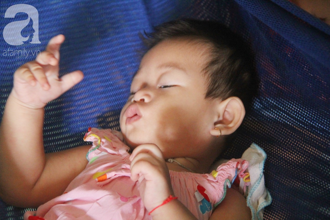 Bé gái 1 tuổi co giật liên tục đến mức méo miệng, bố mẹ nghèo bật khóc khi đã có tiền chữa bệnh cho con - Ảnh 2