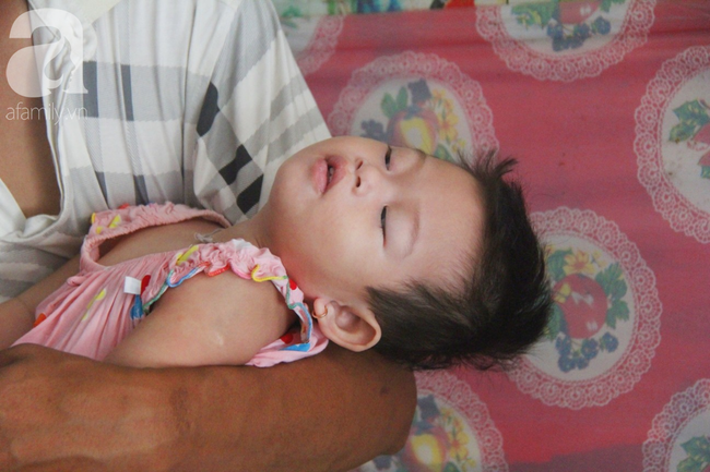 Bé gái 1 tuổi co giật liên tục đến mức méo miệng, bố mẹ nghèo bật khóc khi đã có tiền chữa bệnh cho con - Ảnh 9
