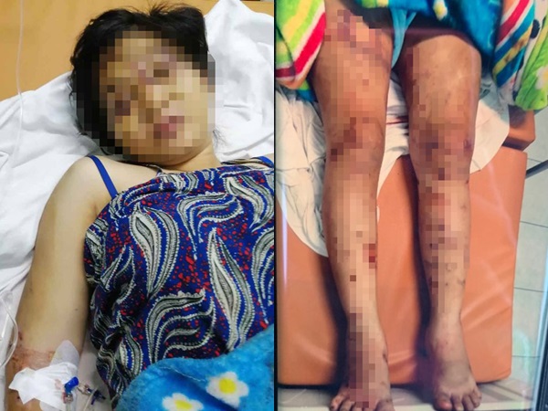 Thai phụ 18 tuổi bị đánh đến sảy thai: Hé lộ thứ bất ngờ được vứt kèm thi thể bé sơ sinh - Ảnh 2