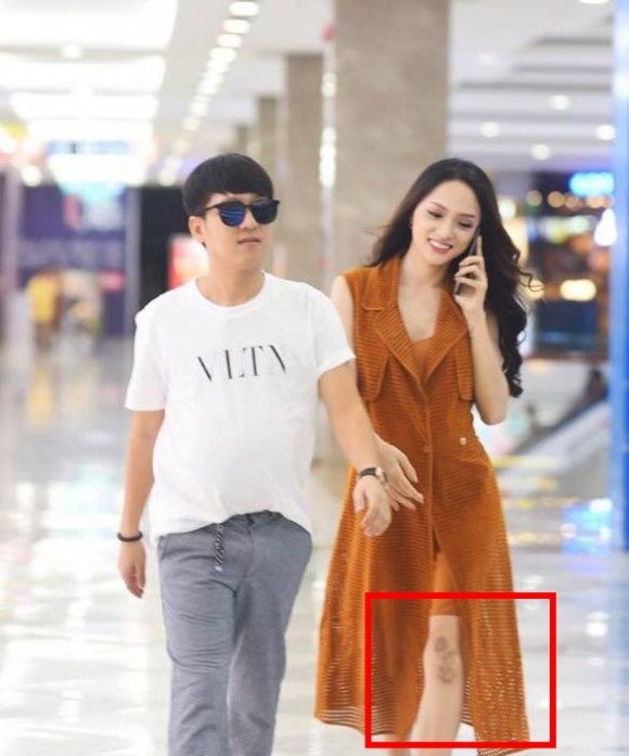 Hoa hậu Hương Giang lộ vết sẹo 'khổng lồ' khó hiểu ở chân khi đi quay cùng Trường Giang - Ảnh 2