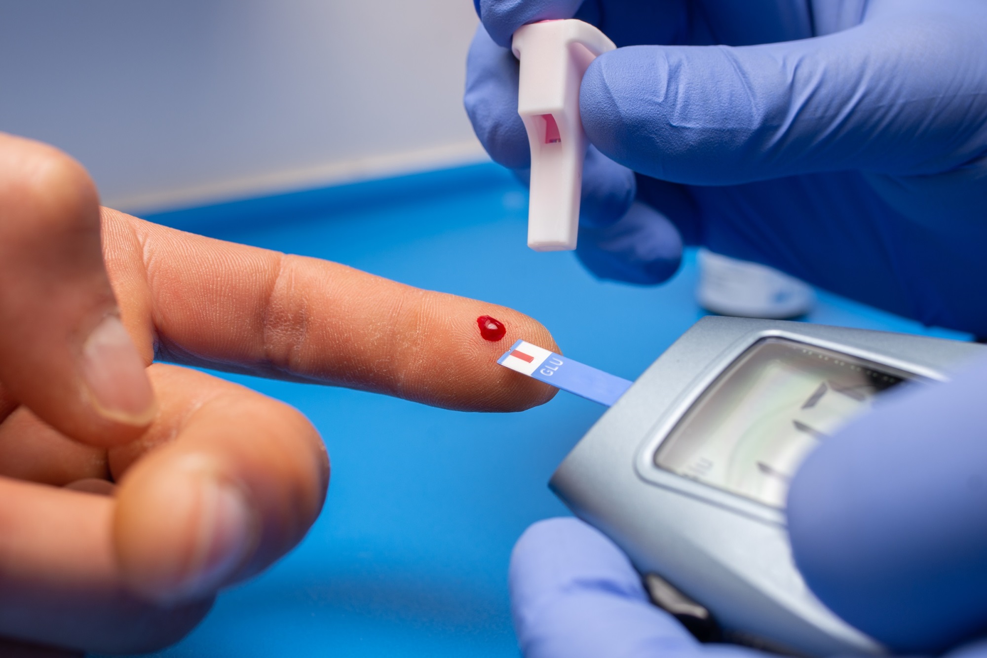 Đối đầu với bệnh tiểu đường: Những điều cần đặc biệt chú ý để tránh tăng đột biến lượng đường trong máu - Ảnh 3