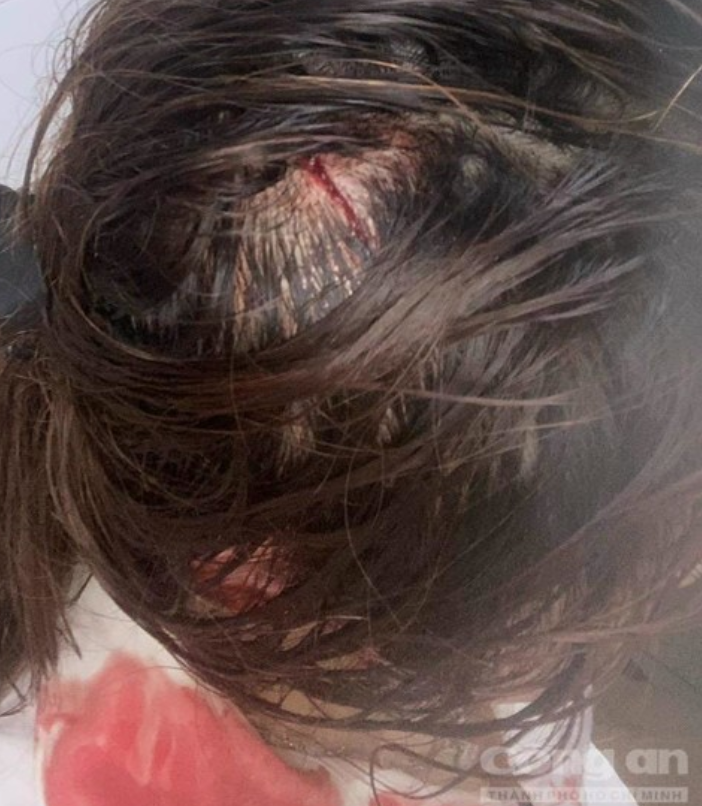 Thông tin MỚI vụ thiếu nữ 16 tuổi bị chủ spa đánh, cắt tóc rồi phát trực tiếp lên mạng, nghi do ghen tuông  - Ảnh 3