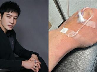 Huỳnh Hiểu Minh nhập viện trong đêm vì dị ứng nặng