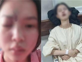 Diễn biến MỚI trong vụ cô gái 17 tuổi ở Đồng Nai bị mù mắt sau khi tiêm filler