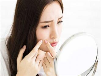 10 thói quen chăm sóc da khiến mặt bạn bị mụn nghiêm trọng hơn
