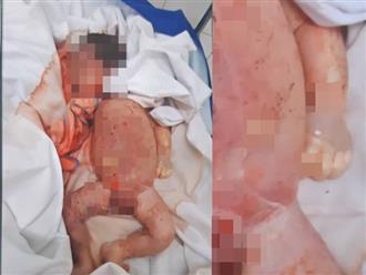 Trẻ sơ sinh tử vong với vết đứt ở cổ: BV ĐK huyện Đức Thọ tạm đình chỉ công tác hai cán bộ nữ hộ sinh