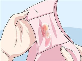 3 dấu hiệu tiết dịch âm đạo ngầm cảnh báo bệnh ung thư cổ tử cung mà nữ giới thường chủ quan bỏ qua
