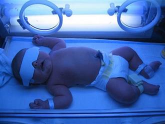 Biện pháp chữa bệnh vàng da an toàn cho trẻ sơ sinh tại nhà