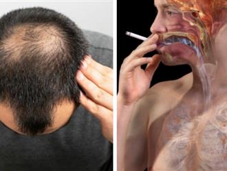 Nghiên cứu chỉ ra mối liên hệ bất ngờ giữa hút thuốc lá và rụng tóc ở nam giới