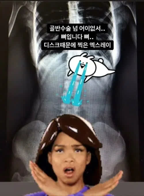 Bị đồn là 'cắt xương sườn' để có 3 vòng bốc lửa, nữ họa sĩ Hàn Quốc đăng ngay ảnh chụp X-quang, tiết lộ sự thật gây sốc - Ảnh 15