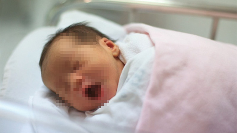 Hi hữu: Tai nạn sau sinh, bé vừa chào đời đã phải khâu 21 mũi - Ảnh 1