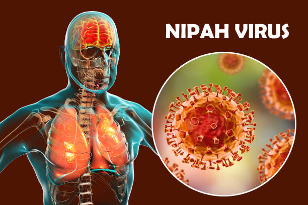 Virus Nipah bùng phát, tỷ lệ tử vong cao gấp hàng chục lần so với COVID-19, chưa có vacccine và thuốc điều trị - Ảnh 2